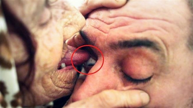 İnsanları yalayarak iyileştiriyor mucize dil inanılmaz... - Resim: 1