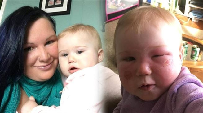 Ödünç krem bu hale getirdi! - Resim: 1