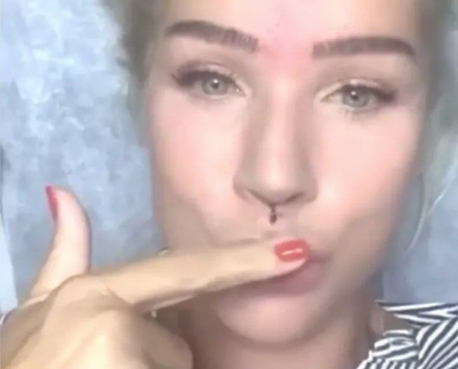 Seda Sayan estetik yaptırdığı anları paylaştı! Bu kez dudağını kaldırttı - Resim: 4