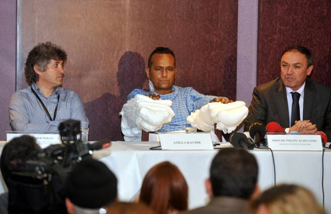 Nakilden sonra ilk kez medya karşısında - Resim: 1