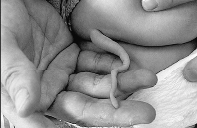 Milyonda bir görünüyor! Doktorlar bile donup kaldı! Böyle bir şey nasıl olur? - Resim: 1