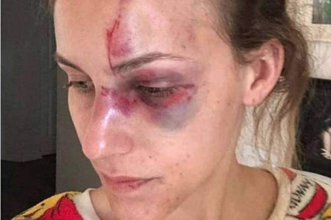 Sevgilisini göğüsleri görünüyor diye komalık etti! Asıl olay ise sonra yaşandı - Resim: 3