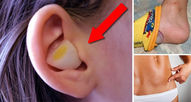 Soğanı alıp kulağınıza sokun olanlara inanamayacaksınız! - Resim: 1