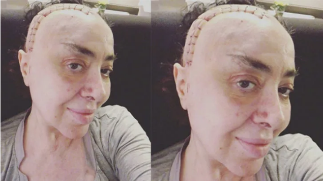 Beyin kanseri teşhisi konan Nur Yerlitaş'a bir fotoğraf paylaşınca mesaj yağdı - Resim: 3