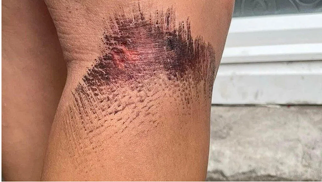 Herşey metroda yaşandı bir ülke o adamı arıyor! 'Tüm vücudumda hissettim' deyip anlattı - Resim: 3