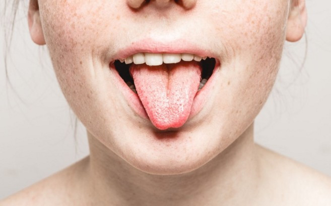 Eğer diliniz çok ıslak ve tükürüklüyse... - Resim: 3