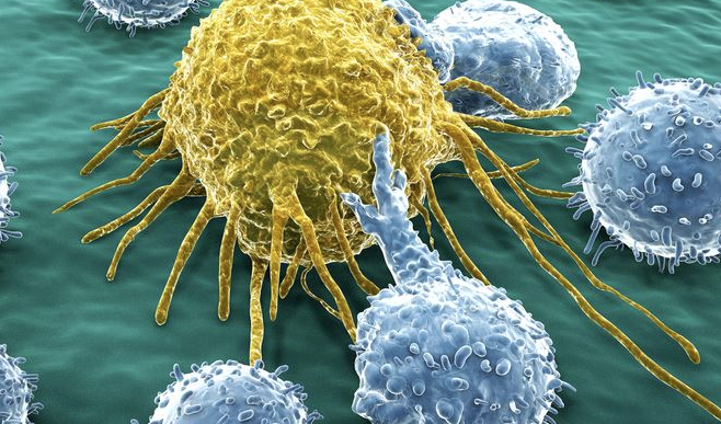 Google teknolojisi meme kanserinde yüzde 99 net sonuç veriyor! - Resim: 1