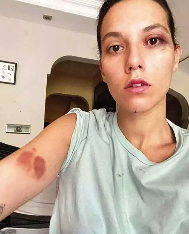 Oyuncu Ozan Güven'e hapis şoku! Deniz Bulutsuz'u darp etmişti, karar açıklandı - Resim: 4