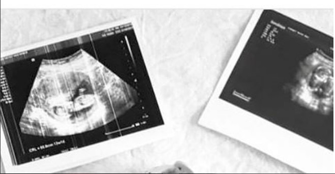 Cansel Çördük hacklendi bir görüntü var ki Eser West çıldırır - Resim: 2