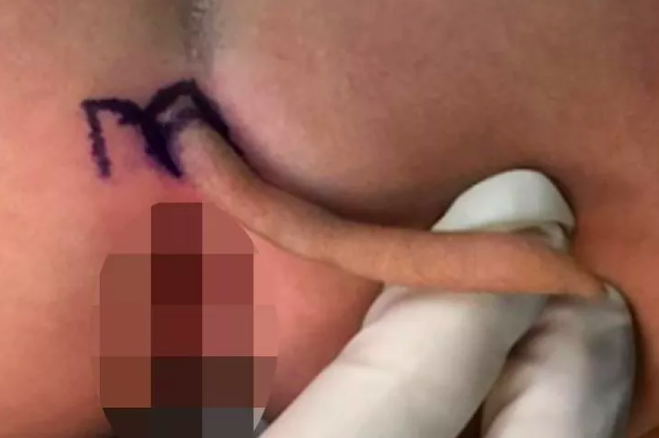 Milyonda bir görünüyor! Doktorlar bile donup kaldı! Böyle bir şey nasıl olur? - Resim: 3