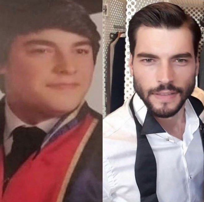 Akın Akınözü evrim geçirmiş eski halini görenlerin ağzı açık kalıyor - Resim: 2