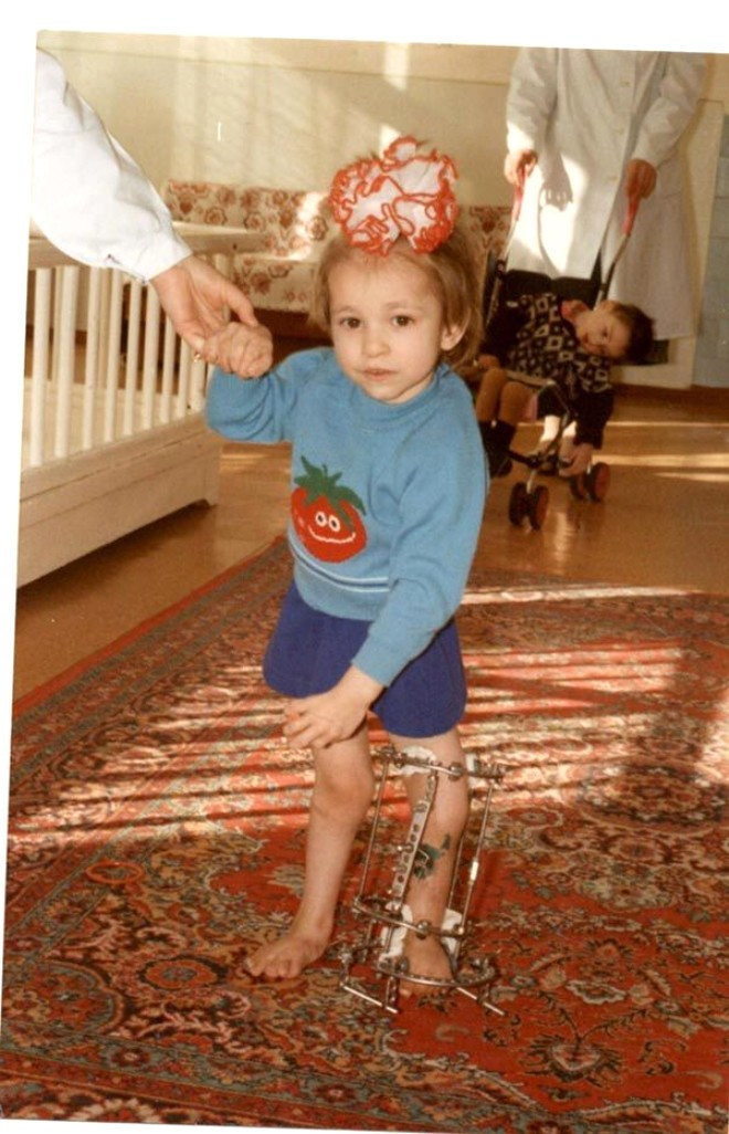 Bacakları kesildi ama pes etmedi inanılmaz mücadele - Resim: 1