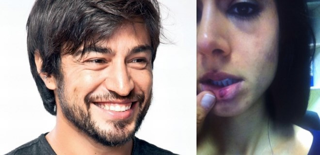 Mahkemeden flaş dayak kararı! İkisi de suçlu... - Resim: 4