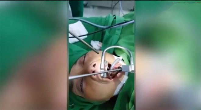 Migren için ameliyata girdi ancak ağzından öyle bir şey çıktı ki! - Resim: 3