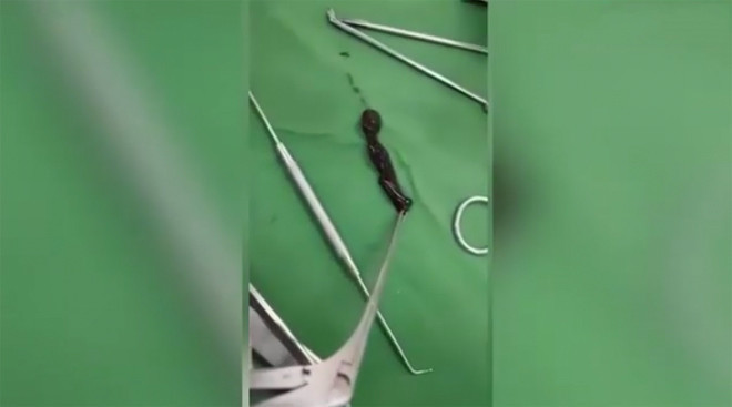 Migren için ameliyata girdi ancak ağzından öyle bir şey çıktı ki! - Resim: 2