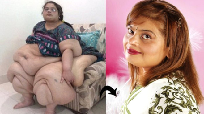 Kiloları hayatını karartmıştı! Son hali bomba - Resim: 3