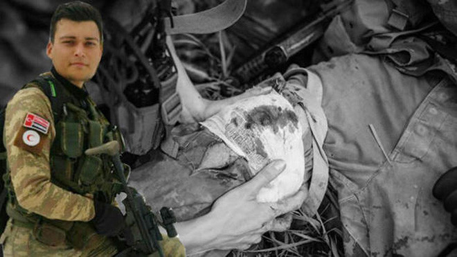 Şehitten hayat kurtaracak icat! Patent başvurusunda bulunmuş - Resim: 1