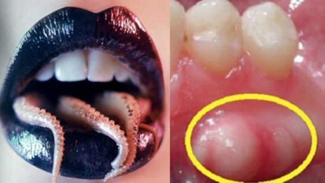 Mürekkep balığından hamile kaldı! Böyle şey görülmedi - Resim: 2