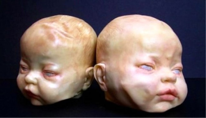 Bedava verseler sizde bunları yemek ister miydiniz?  - Resim: 1