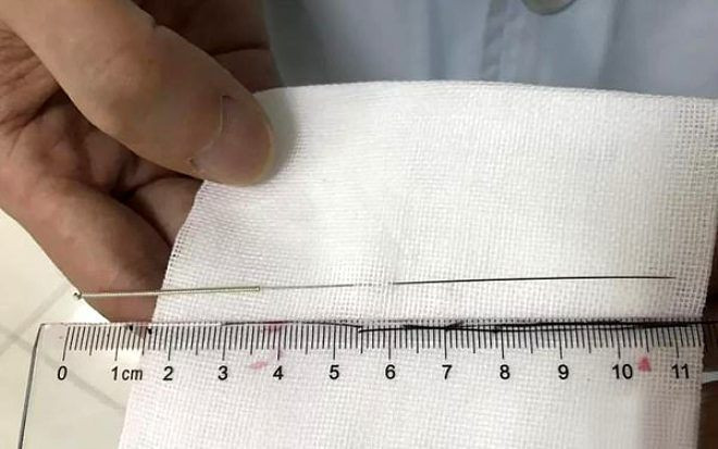 Cinsel organına 11 santimlik iğne soktu! Sebebi akıl alır gibi değil - Resim: 2