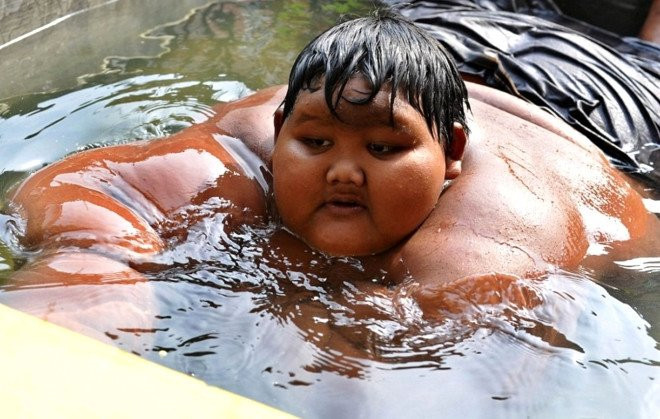 Dünyanın en şişman çocuğuydu! Son hali bomba - Resim: 1