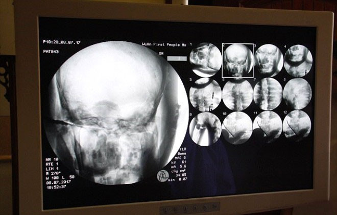 1000 yıllık rahip mumyasından çıkanlar herkesi şoke etti - Resim: 3