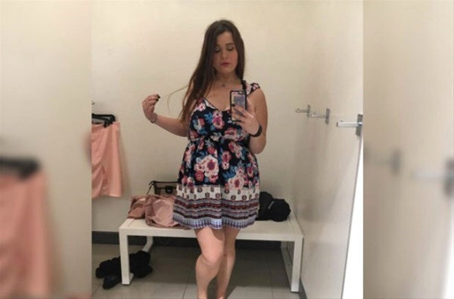 Böyle değişim görülmedi 15 ayda verdiği kiloya bakın! - Resim: 3