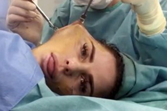 Yüz gerdirirken doktoruyla sohbet etmişti!  Son haline bakın - Resim: 1