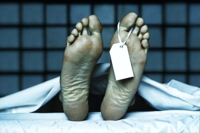 Öldükten 10 dakika sonra çalışıyor inanılmaz buluş - Resim: 2