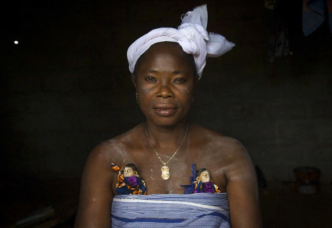 Böyle yas görülmedi ölen bebeklerini göğüslerinde taşıyorlar - Resim: 1