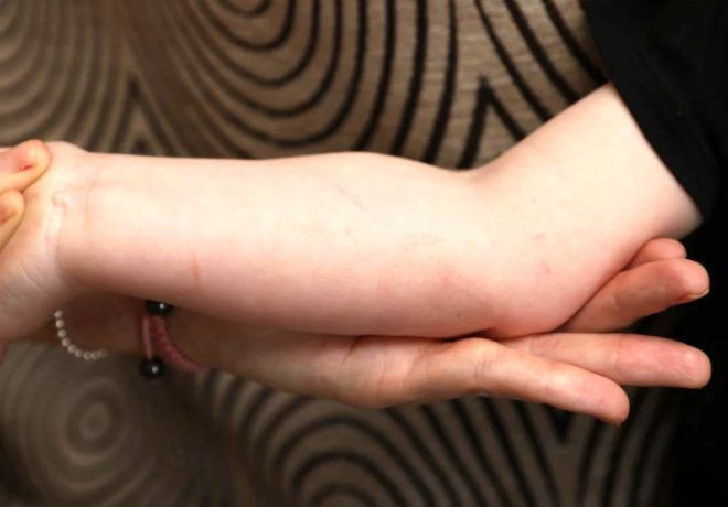 Yer İngiltere! Yarasa 2 yaşındaki çocuğa kabusu yaşattı - Resim: 4