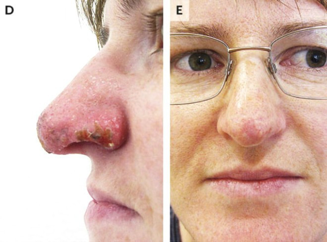 Burnuna bakın ne olduğunu doktorlar da anlamadı - Resim: 4