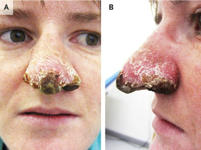 Burnuna bakın ne olduğunu doktorlar da anlamadı - Resim: 2