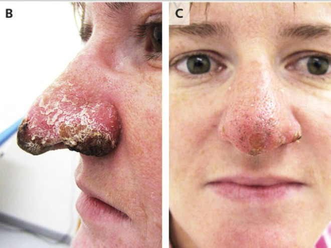 Burnuna bakın ne olduğunu doktorlar da anlamadı - Resim: 3