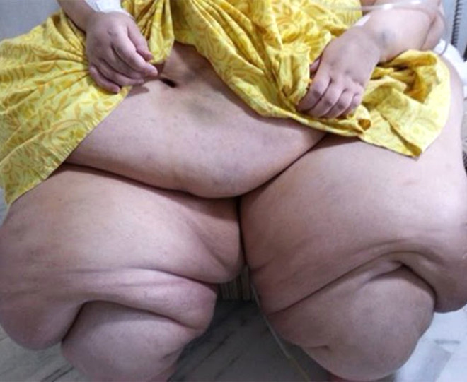 Kiloları hayatını karartmıştı! Son hali bomba - Resim: 4