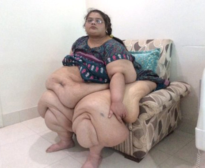 Kiloları hayatını karartmıştı! Son hali bomba - Resim: 2