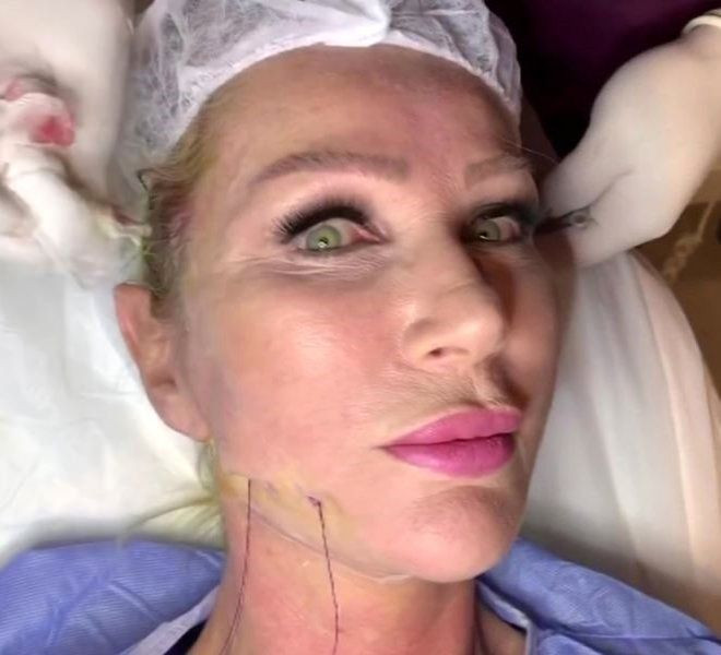 Seda Sayan operasyon görüntülerini paylaştı! Canlı yayında herkesi korkuttu - Resim: 2