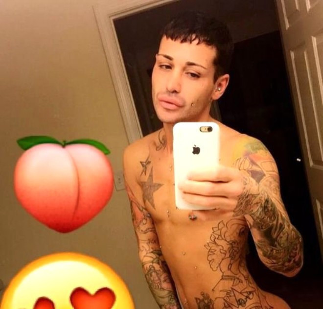 Estetikte hızını alamadı! Kalçasına bile yaptırdı - Resim: 1