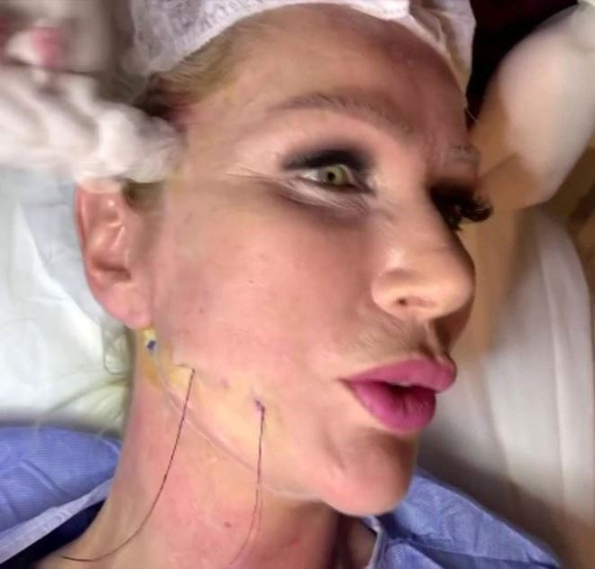 Seda Sayan operasyon görüntülerini paylaştı! Canlı yayında herkesi korkuttu - Resim: 4