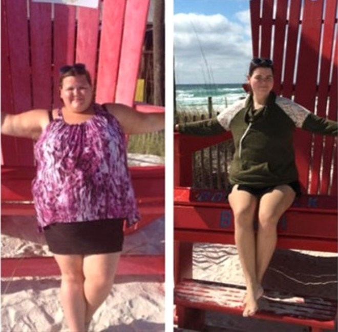 Böyle değişim görülmedi 15 ayda verdiği kiloya bakın! - Resim: 2