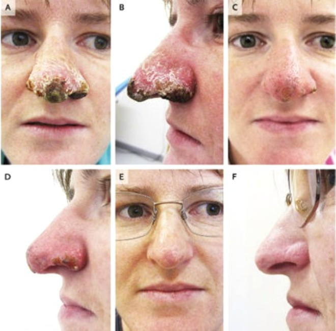 Burnuna bakın ne olduğunu doktorlar da anlamadı - Resim: 1