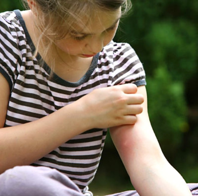 Şampuanın içine tuz koyduğunuz anda yok artık demeyin - Resim: 4