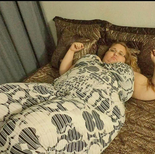 Brezilyalı fenomen ölümün kıyısından döndü bambaşka biri oldu - Resim: 1