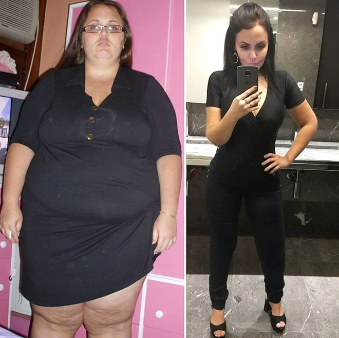 Brezilyalı fenomen ölümün kıyısından döndü bambaşka biri oldu - Resim: 4