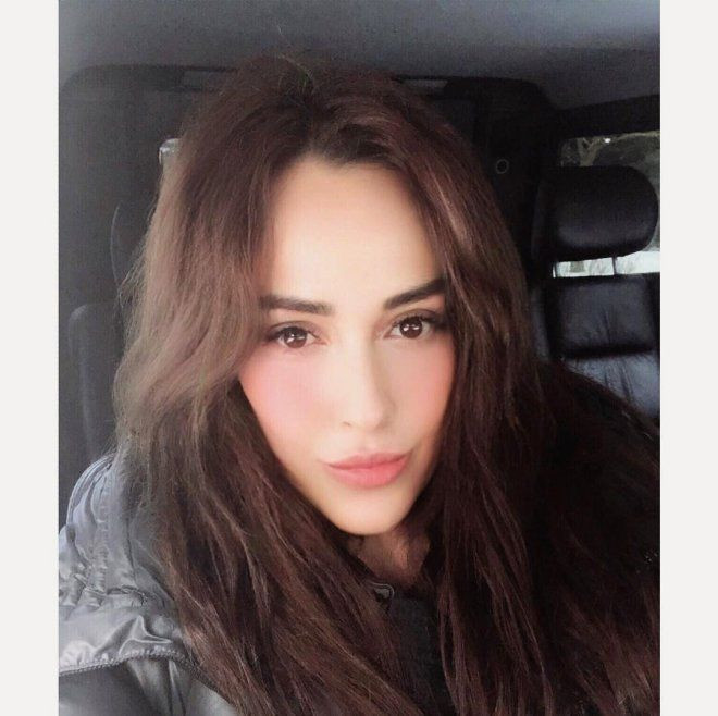 Bambaşka biri olmuştu! Helin Avşar estetik iddialarına cevap verdi - Resim: 3