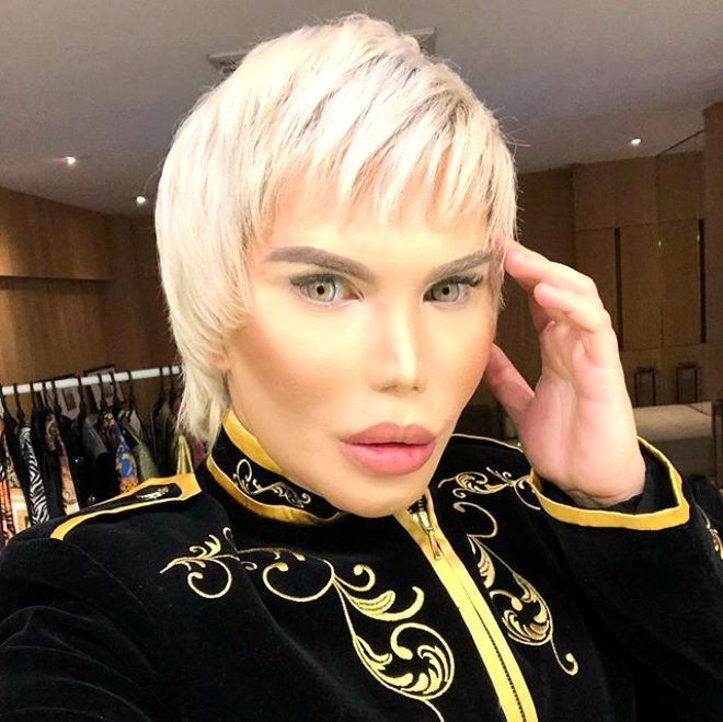 Rodrigo Alves'in son hali korkunç 70 estetik operasyon geçirdi - Resim: 2