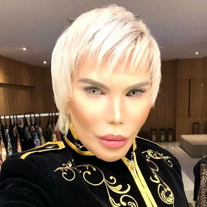 Rodrigo Alves'in son hali korkunç 70 estetik operasyon geçirdi - Resim: 4