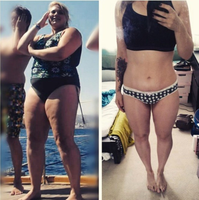 Doktorlar zayıflamazsan kör olacaksın dedi inanılmaz değişim - Resim: 2