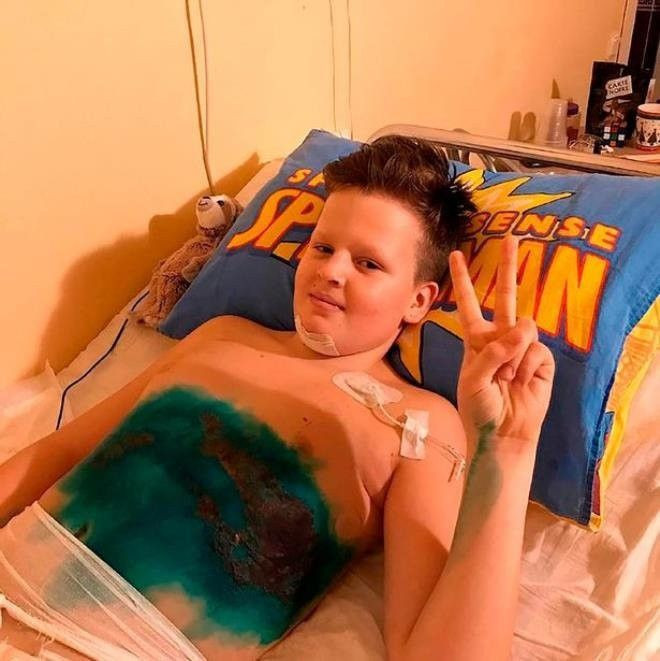 YouTube için video çekerken kabusu yaşadı! Minik çocuğun bacakları koptu - Resim: 4