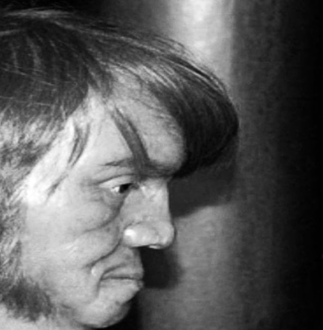 O dünyanın gerçek 'iki yüzlü' insanı inanılır gibi değil - Resim: 3